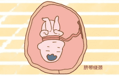 没有结婚证去福建做三代试管麻烦吗？需要花费多少钱