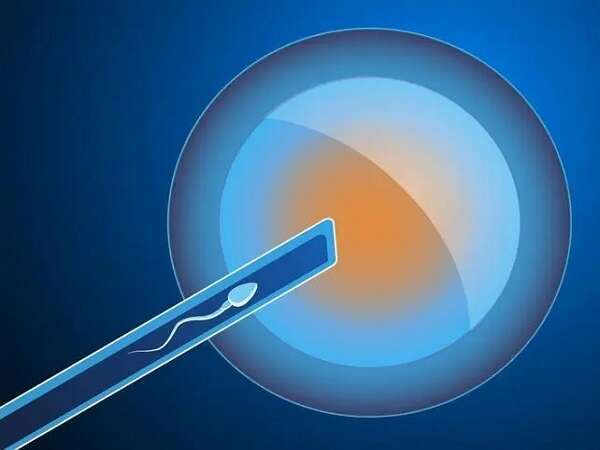 没有结婚证在泉州做三代试管的流程是怎么样的？三代试管攻略大全