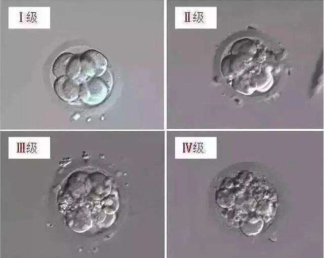 泰国三代试管婴儿费用要多少钱