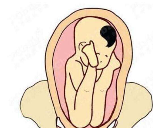 复合型血脂异常做三代试管的成功率高吗？如何才能提升试管成功率