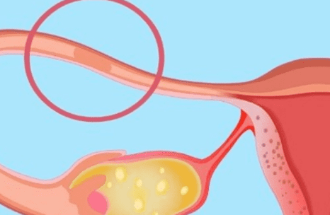 2025年hiv患者做三代试管的成功率高吗？如何才能提升试管成功率