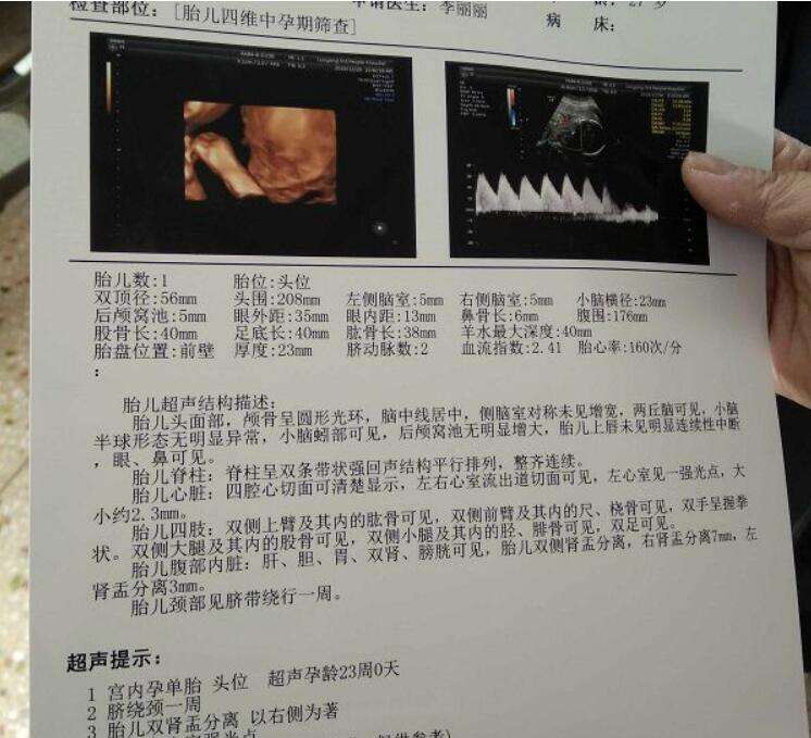 成都可以做第三代试管婴儿？成功率怎么样？