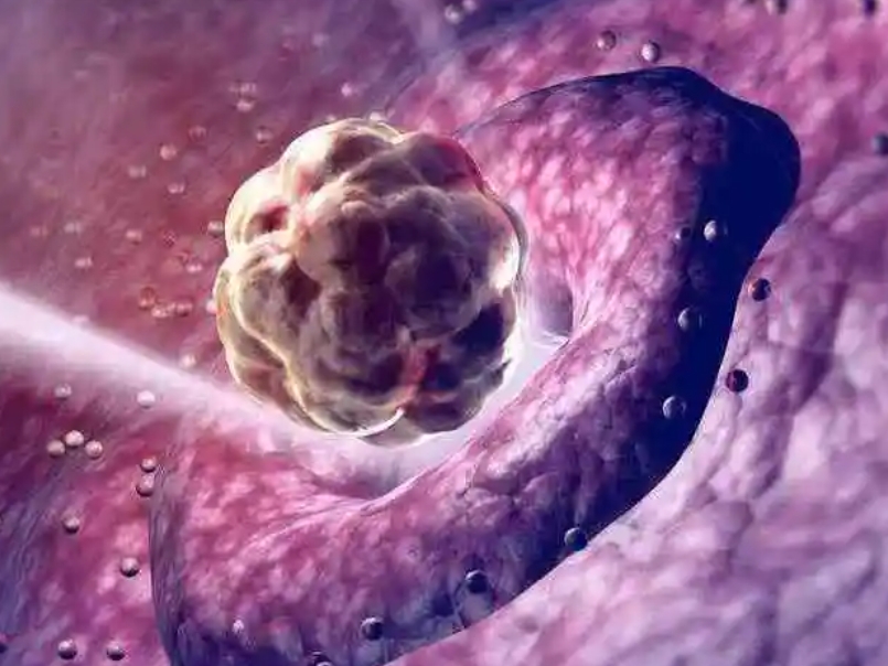 贵阳做试管婴儿成功      需要多少钱呀，一次能成功吗