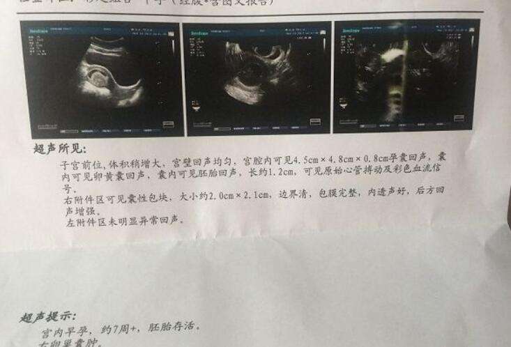 泰国试管婴儿技术排名，专业机构助您好孕