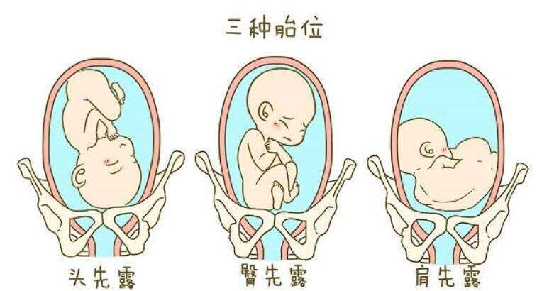 影响试管婴儿费用的因素有哪些？在上海做试管费用贵吗？