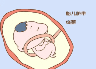 做试管为什么会反复移植失败？这四点原因要注意