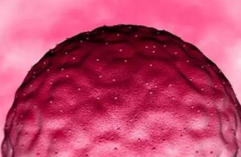 输卵管炎症是什么引起的？有哪些症状？