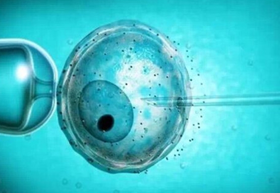 在济南做试管生孩子要多少钱？哪些人适合做试管婴儿？