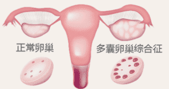 做试管婴儿需要满足哪些条件？这几种人群都适合做