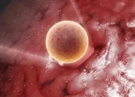 子宫内膜炎有哪些常见症状？要检查哪些项目？