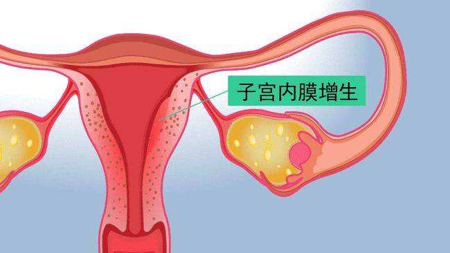 广州不孕试管医院推荐及流程详解