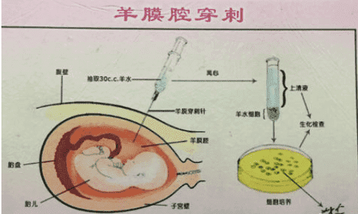 幼稚子宫能怀孕吗？做试管怀孕成功率多少？