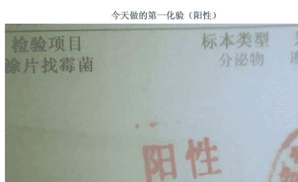 成都试管婴儿必做的前期检查有哪些？