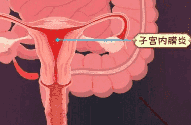 中医疗法可治女性不孕三类人不适合药治
