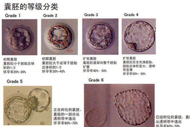 泰国试管婴儿三代多少钱啊？