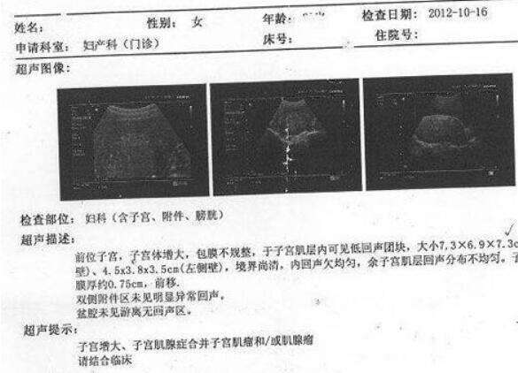 龙岩市艾滋病做试管哪家医院好，费用多少钱？