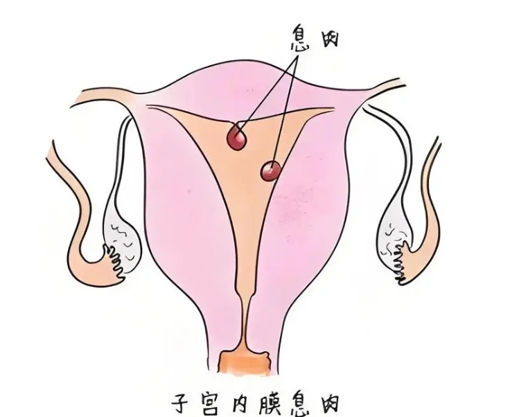 巴中市艾滋病做试管哪家医院好，费用多少钱？