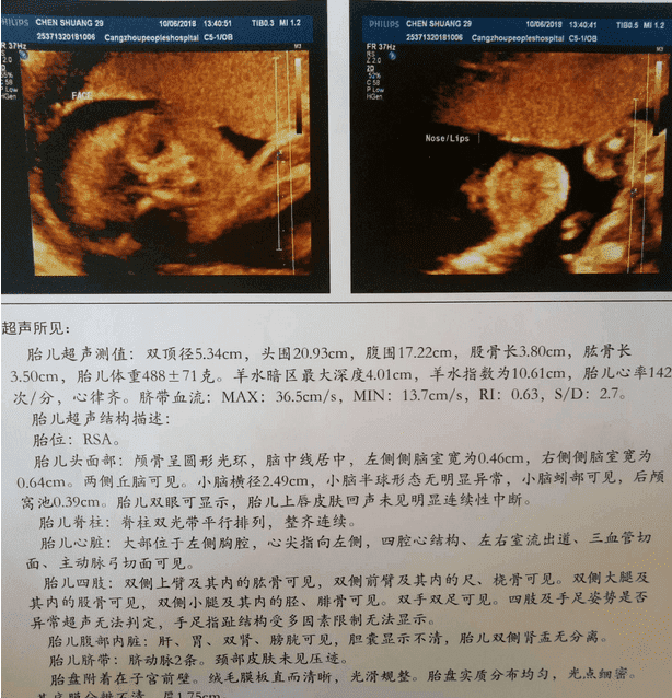 试管婴儿移植后准妈妈应该怎样好好保护自己？