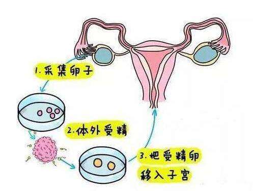 上海三代试管费用完全指南，详细预算及花费划分