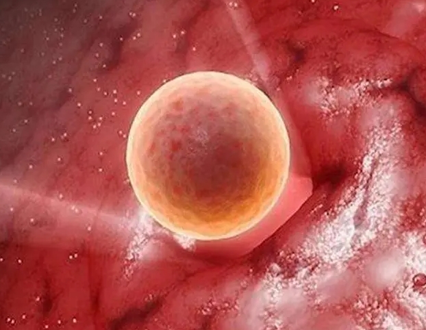 剖腹产疤痕子宫做试管婴儿也需要剖腹吗？