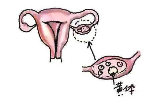 在美国做试管婴儿能够选择宝宝�    吗？
