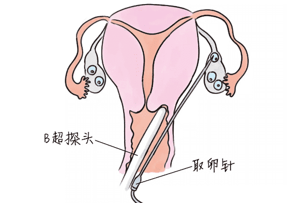 金华市试管婴儿医院排名比较好，金华市试管婴儿成功率医院排名