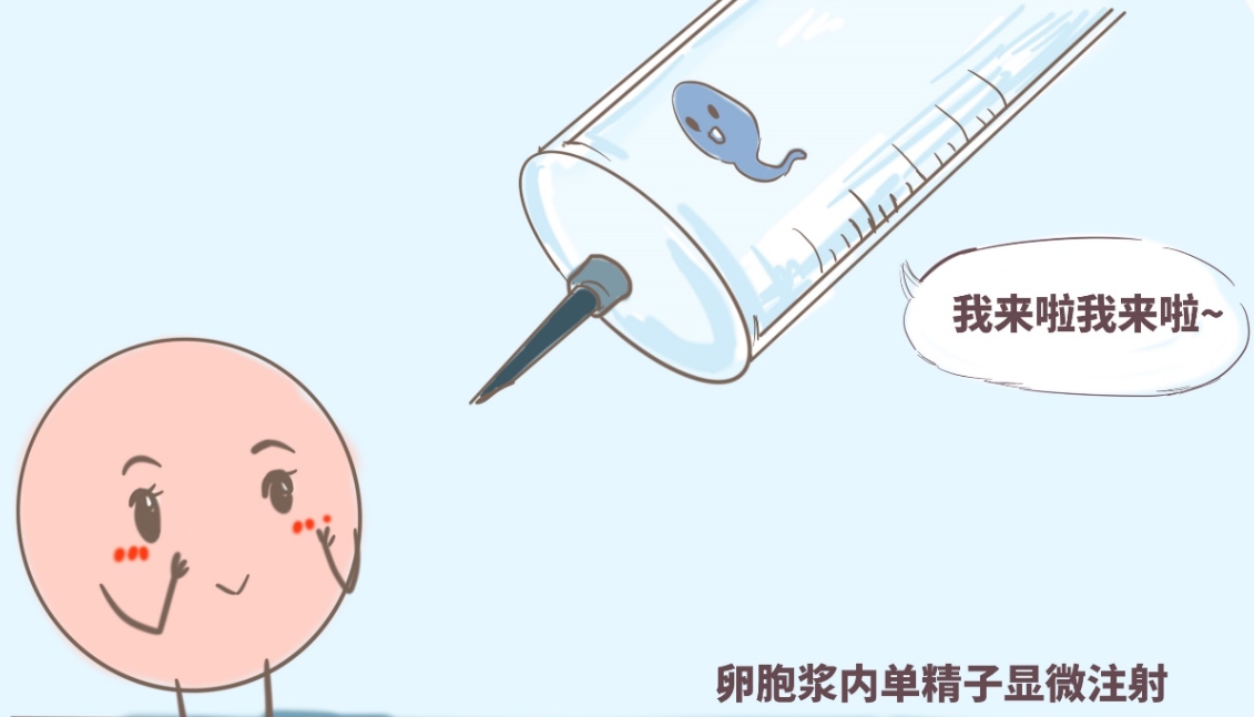 卵巢囊肿做试管婴儿需要穿刺吗？试管穿刺疼吗？