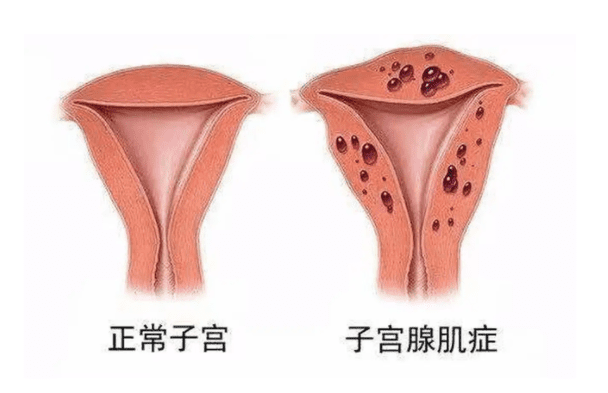泰国试管婴儿中国机构，泰国试管婴儿中国合作机构推荐
