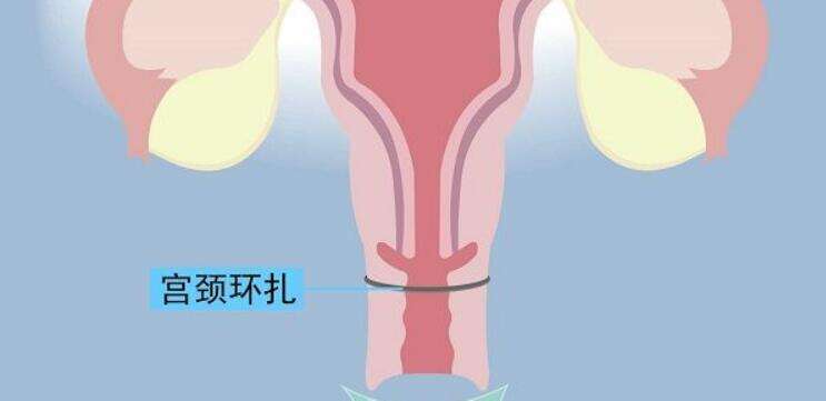 怎么去泰国试管婴儿，全方位攻略