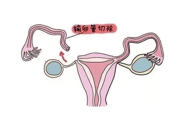 泰国试管婴儿经验，泰国试管婴儿心得分享