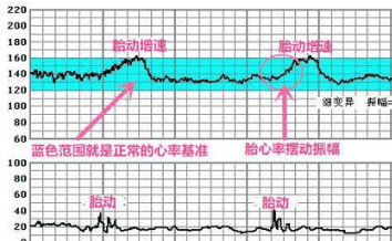 美国三代试管婴儿费用全解析，从术前检查到成功怀孕的每一步花销