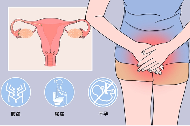泰国试管婴儿费用一般多少钱？