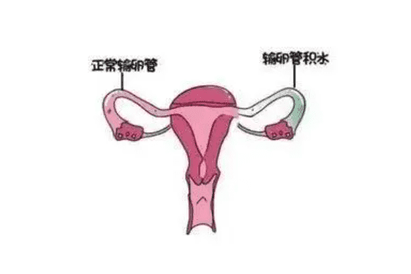 哈萨克斯坦试管婴儿服务，哈萨克斯坦试管婴儿技术优势