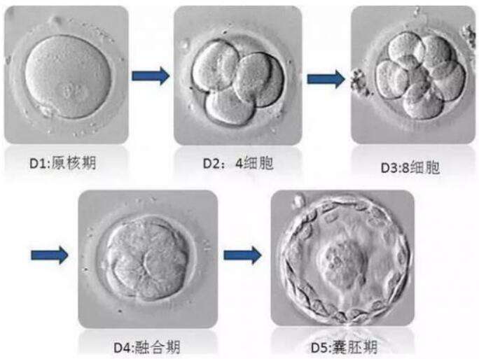 哈萨克斯坦试管婴儿攻略？哈萨克斯坦做试管婴儿需要准备什么？