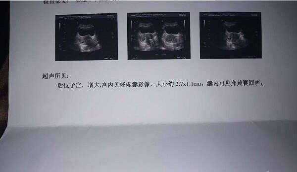 美国第三代试管婴儿医院，美国第三代试管婴儿技术医院推荐