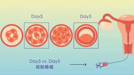 高龄女性为什么容易试管助孕失败？这样可提高受孕率