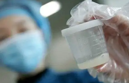 做试管婴儿要不要养囊？看完你就知道了