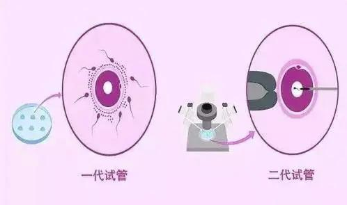 美国做三代试管婴儿费用是多少钱呢