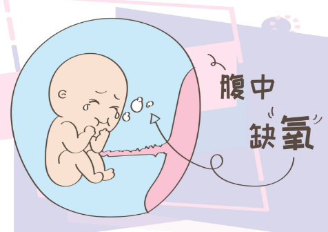 孕期检查出胎儿窘迫后有什么方法可以进行改善？