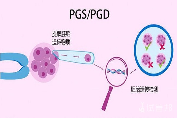 上海三代试管婴儿技术成熟吗？对胚胎的安全性如何保障？